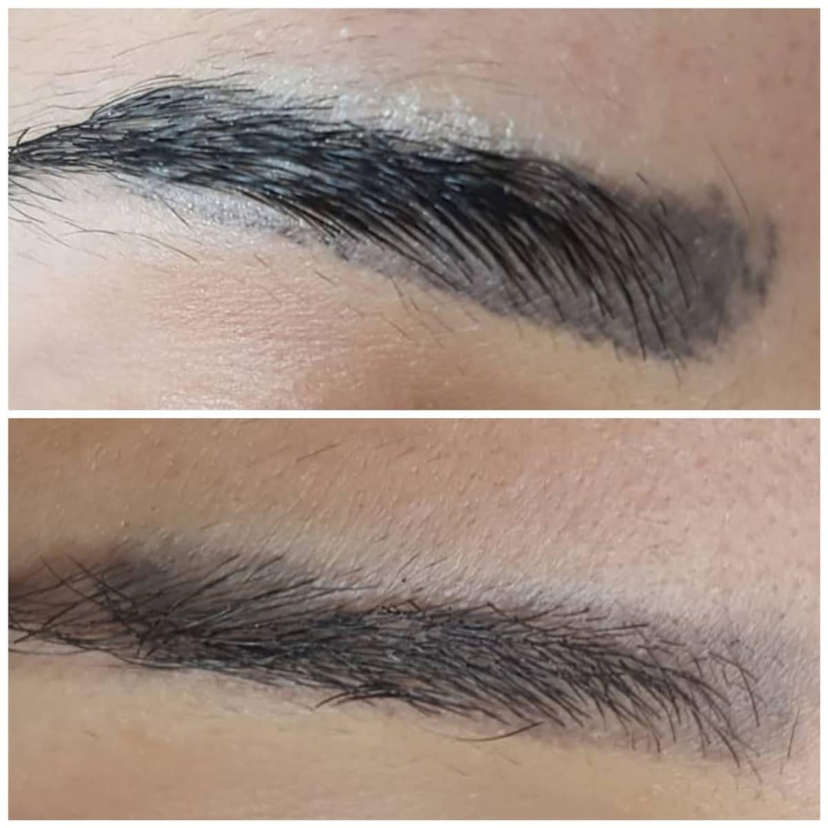 Saline Tattoo & PMU Removal