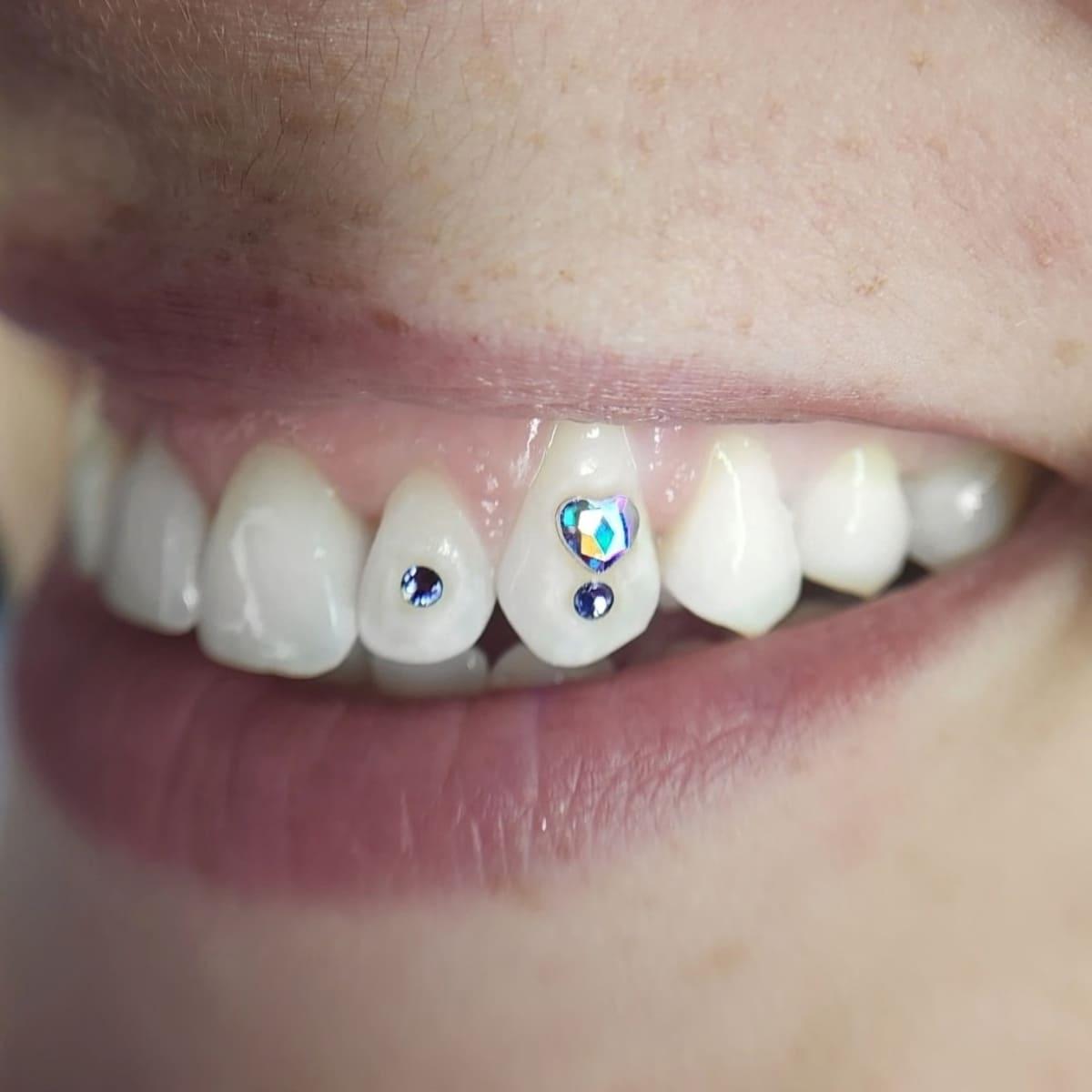 Swarovski Tooth Gems